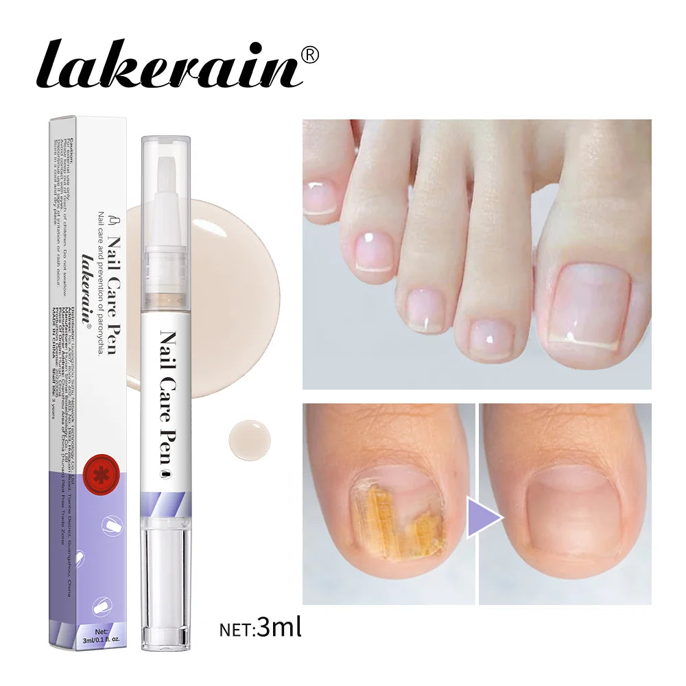 Nail Care Pen Nourish and Moisturize Nails Prevent Fungal Infections Improve Appearance Flat Brush Head Design Daily Nail Care