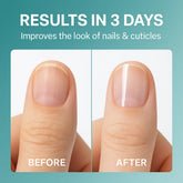 3 Days Nail Care Oil 