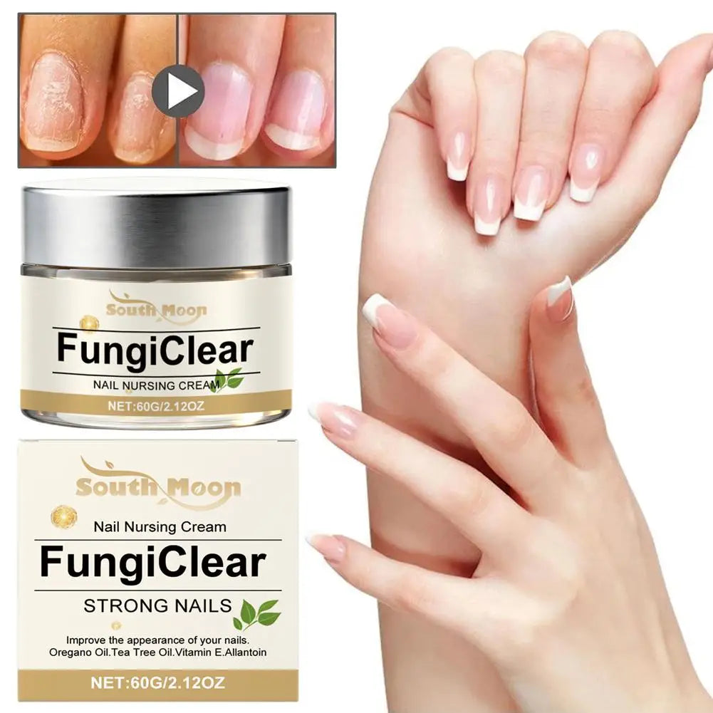 Nail Nursing Cream Fungi Clear Improve Nails Appearance Oregano Oil Tea Tree Oil Vitamin E Nail Daily Care Cream