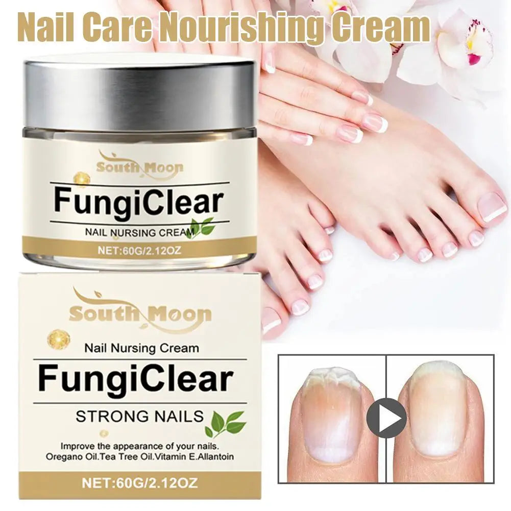 Nail Nursing Cream Fungi Clear Improve Nails Appearance Oregano Oil Tea Tree Oil Vitamin E Nail Daily Care Cream