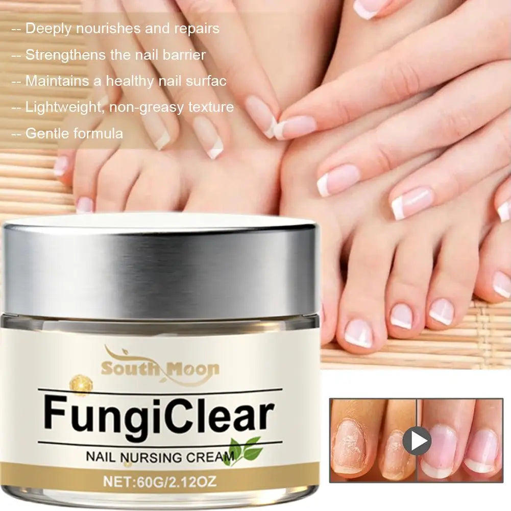 Nail Nursing Cream Fungi Clear Improve Nails Appearance Oregano Oil Tea Tree Oil Vitamin E Nail Daily Care Cream