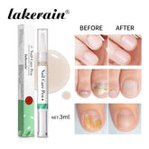 Nail Care Pen Nourish
