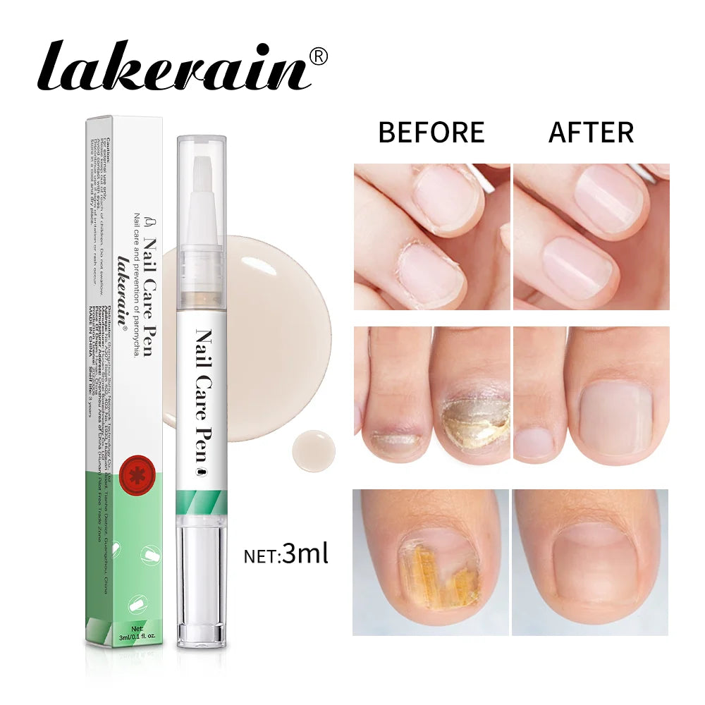 Nail Care Pen Nourish and Moisturize Nails Prevent Fungal Infections Improve Appearance Flat Brush Head Design Daily Nail Care