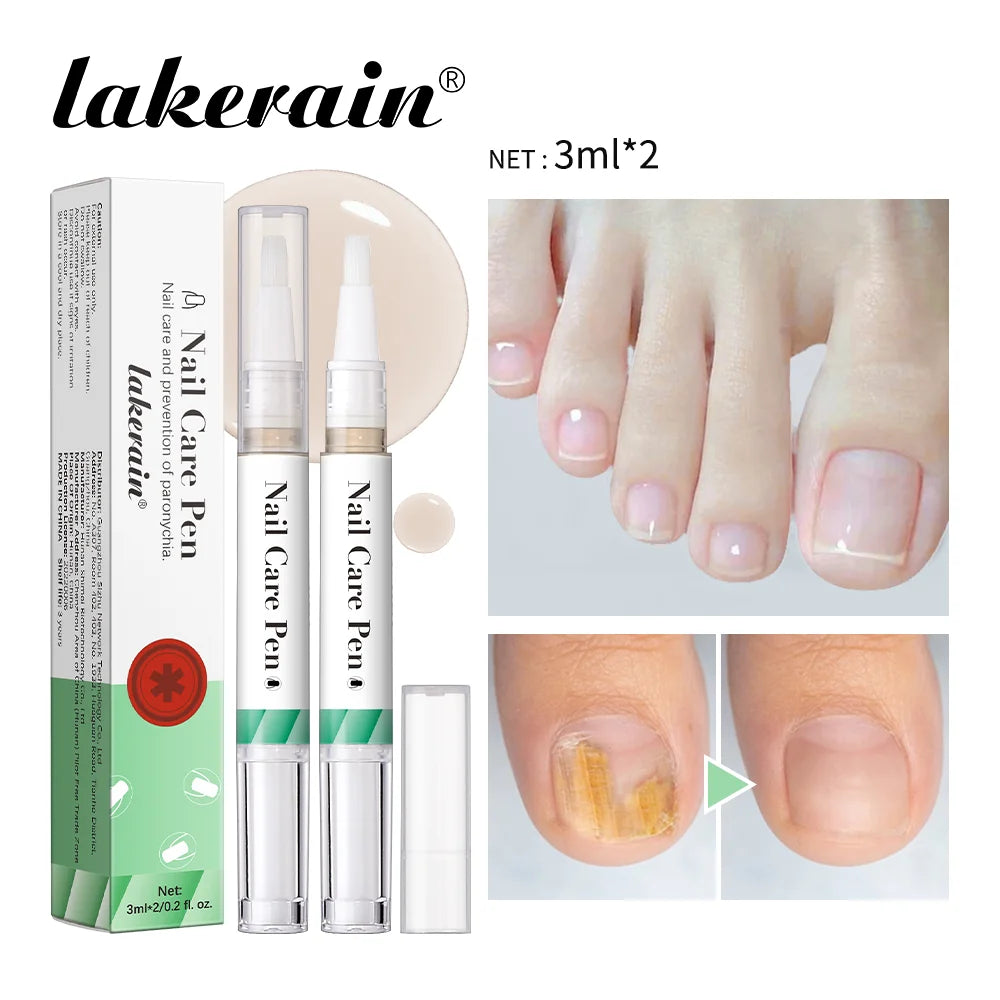 Nail Care Pen Nourish and Moisturize Nails Prevent Fungal Infections Improve Appearance Flat Brush Head Design Daily Nail Care