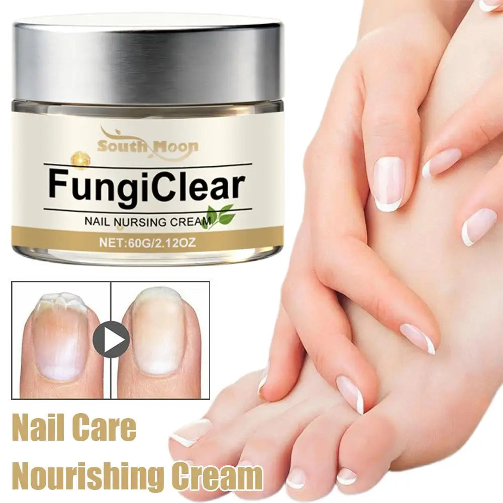 Nail Nursing Cream Fungi Clear Improve Nails Appearance Oregano Oil Tea Tree Oil Vitamin E Nail Daily Care Cream