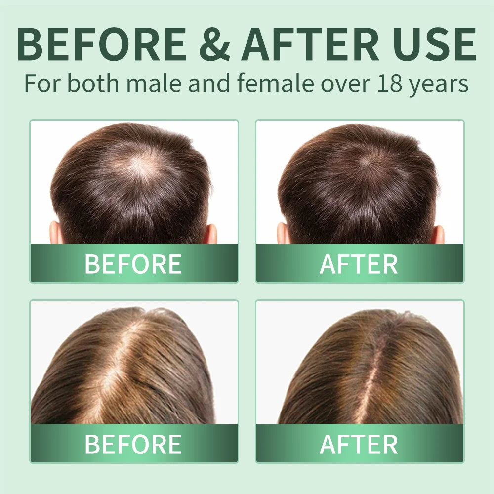 Hair Growth Spray,Scalp Scrub,Rosemary Scalp Exfoliator Scrub Shampoo,Hair Booster Serum,Strengthens Hair Roots,Helps Strengthen
