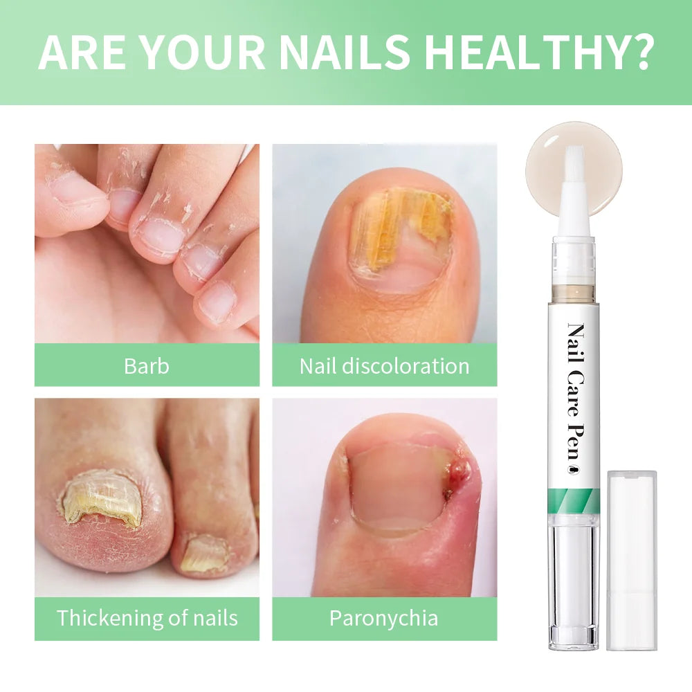 Nail Care Pen Nourish and Moisturize Nails Prevent Fungal Infections Improve Appearance Flat Brush Head Design Daily Nail Care