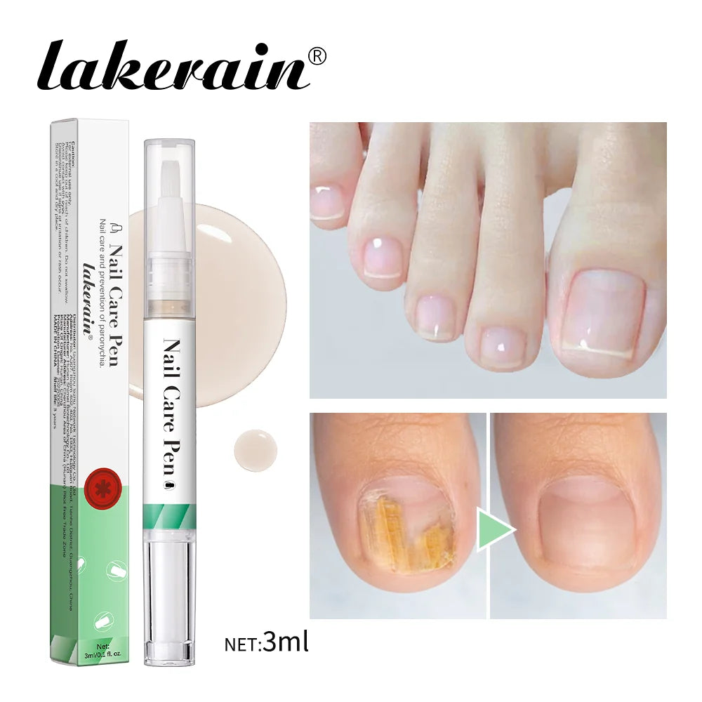 Nail Care Pen Nourish and Moisturize Nails Prevent Fungal Infections Improve Appearance Flat Brush Head Design Daily Nail Care