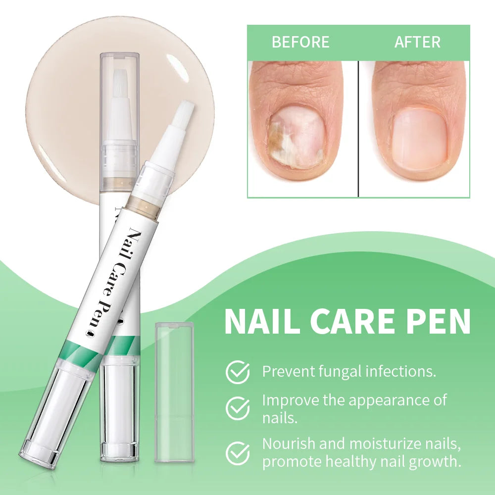 Nail Care Pen Nourish and Moisturize Nails Prevent Fungal Infections Improve Appearance Flat Brush Head Design Daily Nail Care