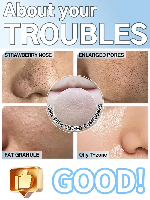 Glow-Up Pore Vacuum Cleaner